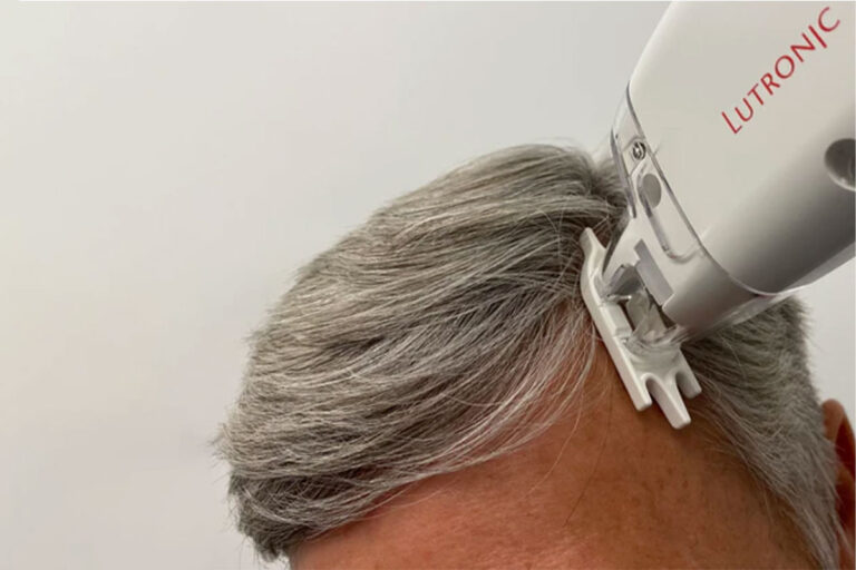 KeraLase Hair Rejuvenation in Scottsdale, AZ Aesthetic Assets