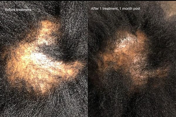 Hair-Rejuvenation-5 Hair-Rejuvenation-5